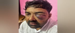 पिटाई प्रकरण में SOG के कई पुलिसकर्मी जांच के घेरे में, दिग्विजय भाटी करेंगे पहचान